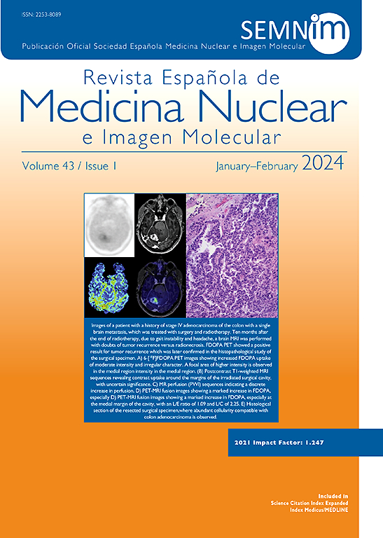 Go to journal home page - Revista Española de Medicina Nuclear e Imagen Molecular (English Edition)